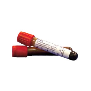 Quality and Process Controls Quality and Process Controls